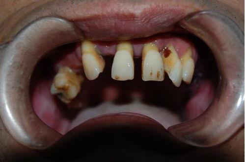 缺牙最新吃瓜视频,揭秘缺牙界的惊天秘密！